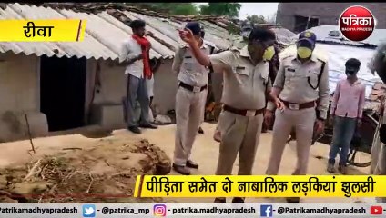 रीवा : एक तरफा मोहब्बत में युवती पर किया एसिड अटैक