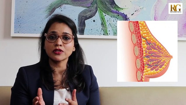 Is liposuction a Treatment Option For Breast Reduction? Dr Priya Bansal - Female Plastic Surgeon