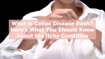 What Is Celiac Disease Rash? Here’s What You Should Know About the Itchy Condition