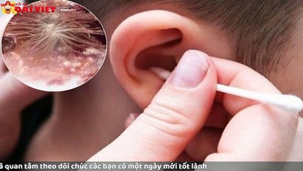 Mơ thấy ngứa tai có tỉ lệ trúng cao nhất