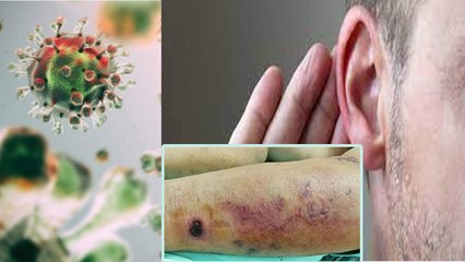 Corona Delta Variant है बेहद खतरनाक Patients में दिखी ये नई बीमारियां| Boldsky