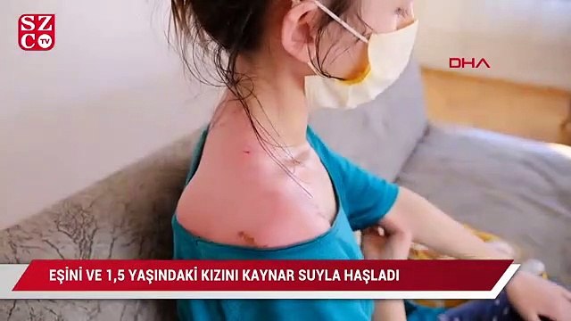 Eşini ve 1,5 yaşındaki kızını kaynar suyla haşladı