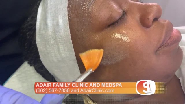 Adair Family Clinic and Medspa has a special offer for an acne treatment