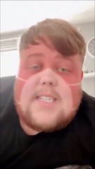 Il s'est endormi au soleil avec son masque !