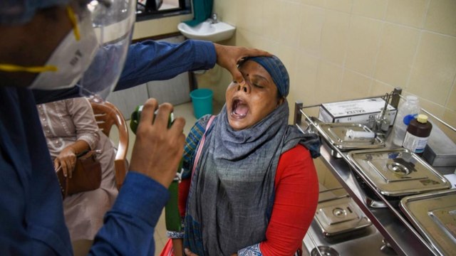 MP: Black fungus cases rise in Indore, 49 succumb