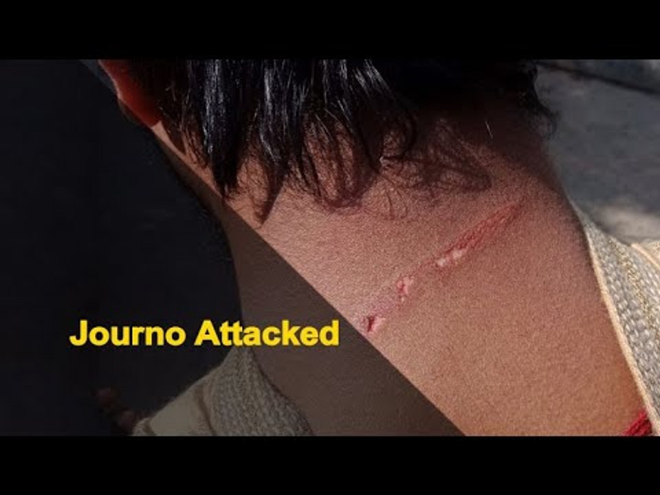 Reporter, Video Journalist Thrashed By Mob In Puri | OTV News