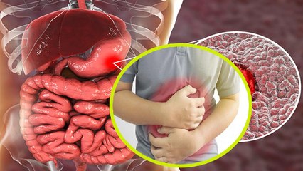 Stomach Pain को न करें अनदेखा, हो सकती है ये गंभीर बीमारी । जानिए लक्षण और बचाव के तरीके । Boldsky