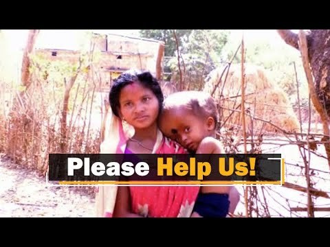 Odisha | Family Of Baby With Hydrocephalus Condition Awaits Govt Help | OTV News
