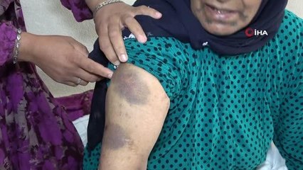 Yaşlı kadına yoğun bakımda darp iddiası