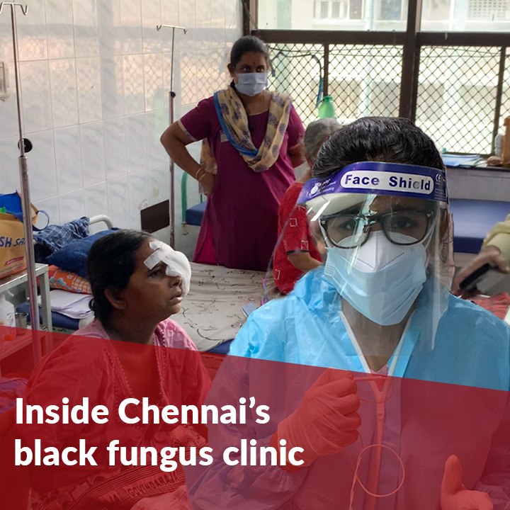 Inside Chennai’s first-of-a-kind black fungus treatment ward