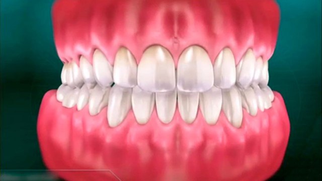 bd-consecuencias-por-masticar-de-un-solo-lado-110621