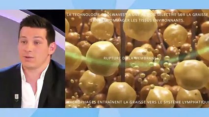 Les micro-ondes, la technologie minceur révolutionnaire avec Deka