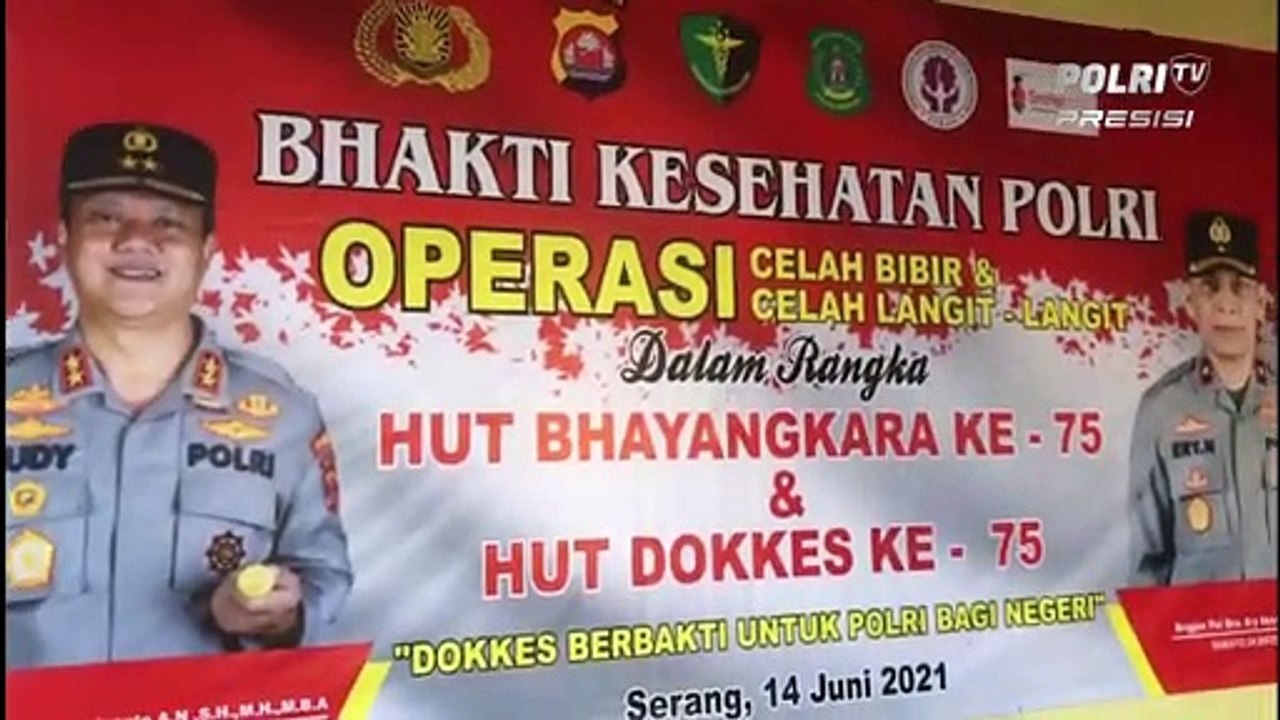 HUT Bhayangkara Ke-75, Biddokes Polda Banten Gelar Operasi Bibir Sumbing Gratis