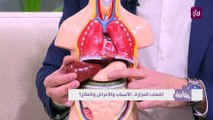 التهاب المرارة.. الأسباب والأعراض والعلاج؟