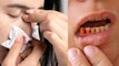 Long Covid में मसूड़ों और नाक से बहे खून तो ना करें नजरअंदाज, Doctors Advice | Boldsky