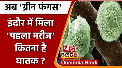 Green Fungus:Indore में Green Fungus का पहला केस, मरीज को यरलिफ्ट कर Mumbai भेजा | वनइंडिया हिंदी
