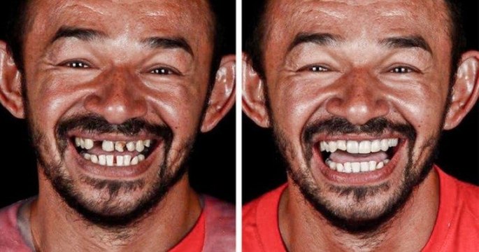Ce dentiste brésilien voyage à travers le monde pour offrir des soins dentaires aux plus démunis