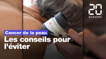 Cancer de la peau: Les conseils pour l'éviter