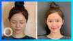 Elf Ear, Tren Operasi Telinga di China yang Bikin Wajah Tampak Lebih Kecil - TomoNews