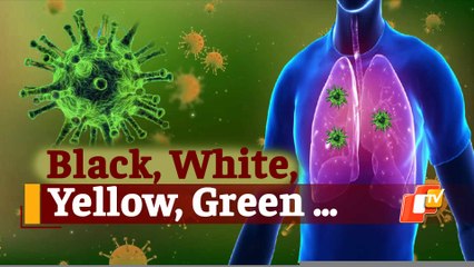 After Black, White and Yellow, Green Fungus Case Reported In Madhya Pradesh