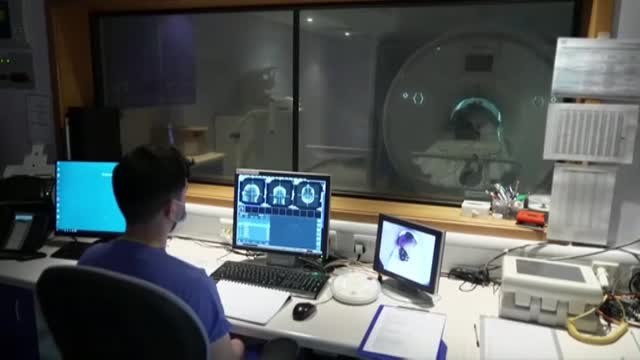 Un paciente recibe el primer fármaco específico contra el alzhéimer