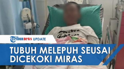 Remaja Berkebutuhan Khusus Dicekoki Miras hingga Tubuh Melepuh, Dokter Idap Sindrom Stevens Johnson