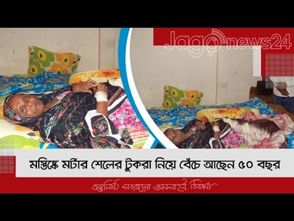 মস্তিষ্কে মর্টার শেলের টুকরা নিয়ে বেঁচে আছেন ৫০ বছর | Jagonews24.com