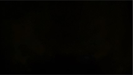 This Girl Is Left With Severe Burns After Poached Egg Exploded In her Face