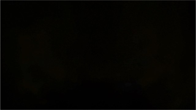 This Girl Is Left With Severe Burns After Poached Egg Exploded In her Face