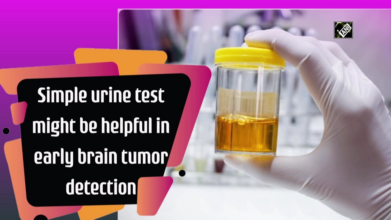 A simple urine test might be helpful in detecti...