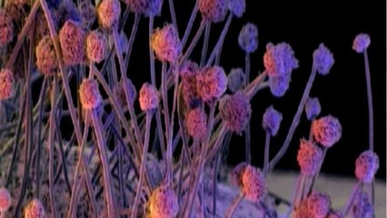 First Case of Green Fungus Detected in India