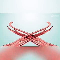 Apucaranense recebe alta da UTI covid