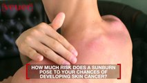 How Much Does One Sunburn Up Your Risk of Skin Cancer?