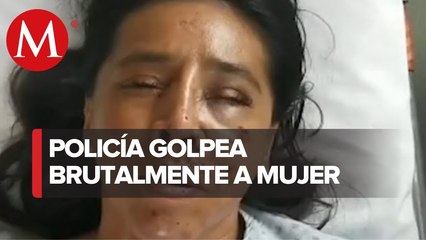 En Edomex, Aracely fue atacada por su cuñado; autoridades dejan libre al agresor
