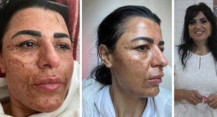 Güzellik merkezine gitti: Kâbusu yaşadı