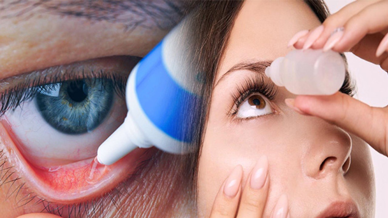 Eye Drop  डालते समय क्या आप भी करते हैं ये गलती...