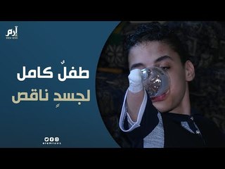 زياد.. قصة طفل كامل لجسد ناقص أطرافه الأربعة - آلاء طاهر