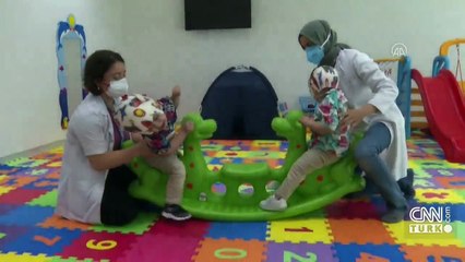 Siyam ikizleri iyileşiyor