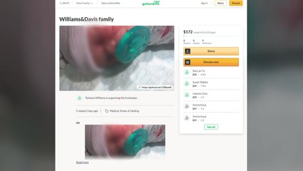 美 제왕절개 수술 중 아기 얼굴에 칼자국...13바늘 봉합 / YTN