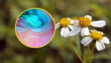 新しい耳垢のクリーニング  鼓膜の柔らかい耳垢 #St.02