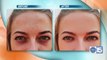 See Turn Back Time Spa & Wellness Clinic use intense pulse light to remove dark spots and reduce lines and wrinkles