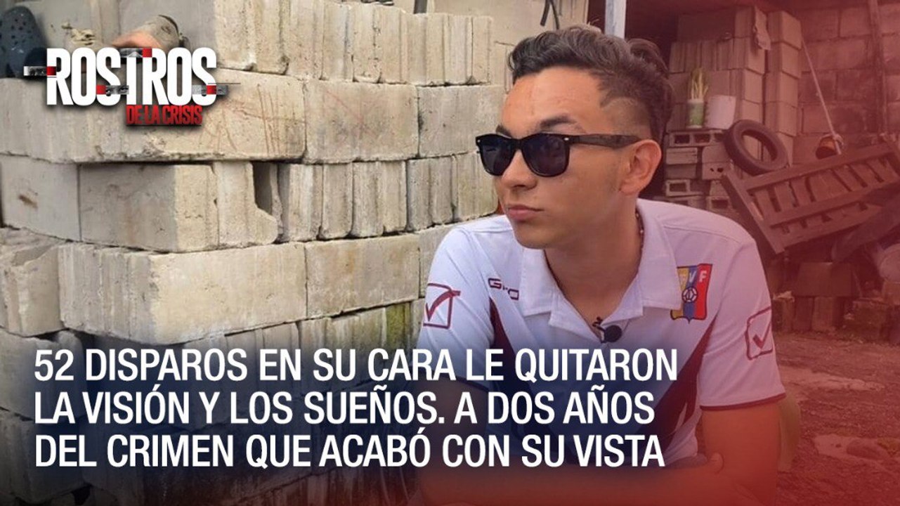 52 disparos en su cara le quitaron la visión y...