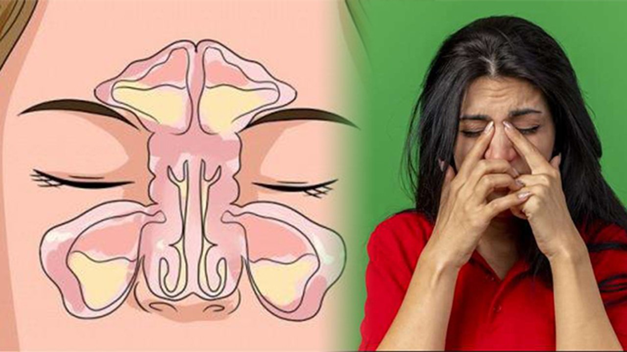 बिना Cold Cough नाक बंद होना कैसे ठीक करें | क्...