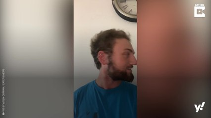 21-Jähriger hat nach Haartransplantation wieder volles Haar