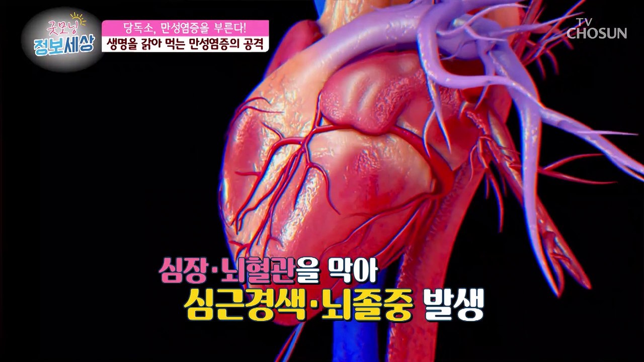돌연사의 원인!! 만성염증☠ 예방하지 않으면 암이 된다?! TV CHOSUN 2106...