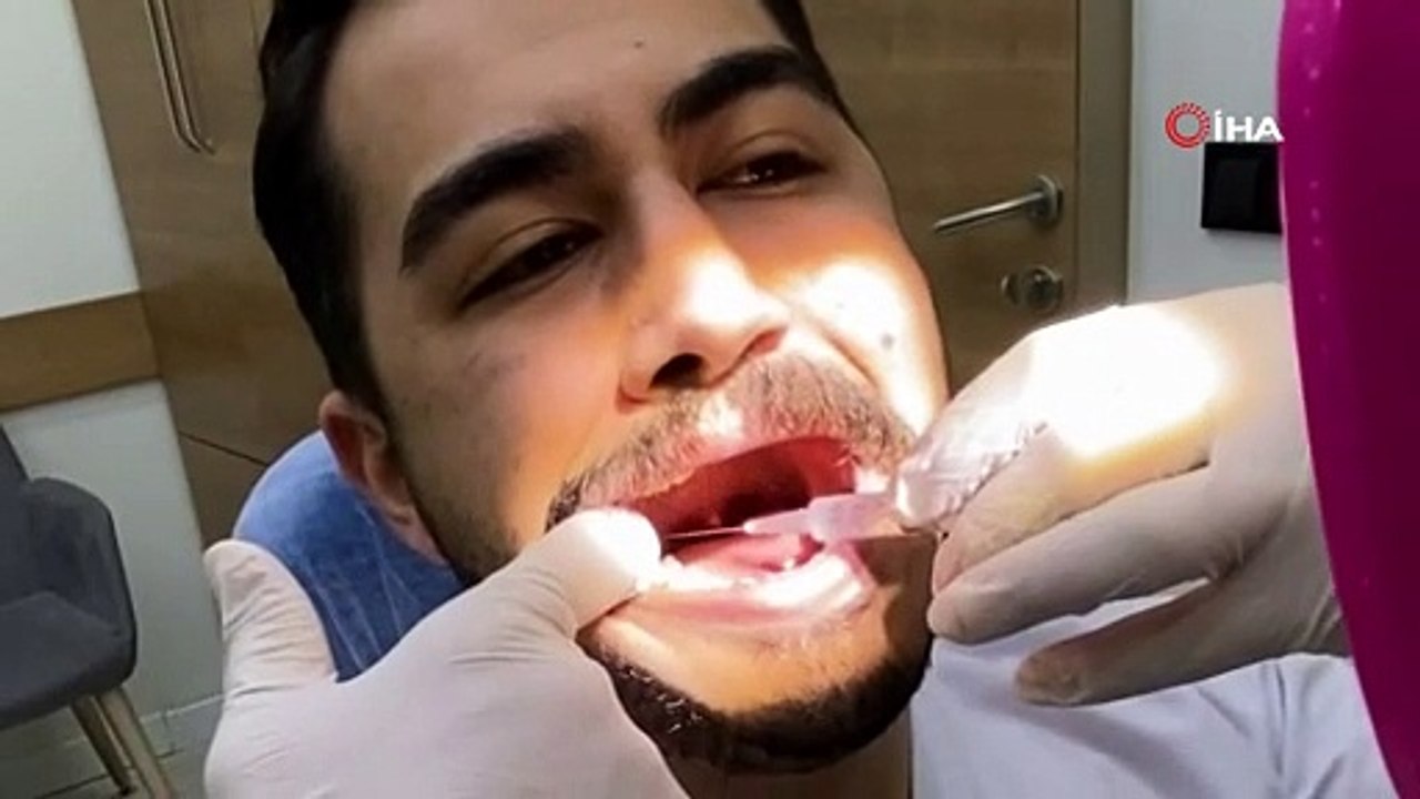 ''Terzi söküğünü dikemez'' sözünü yalanlayan dişçi kendi dişini çekti