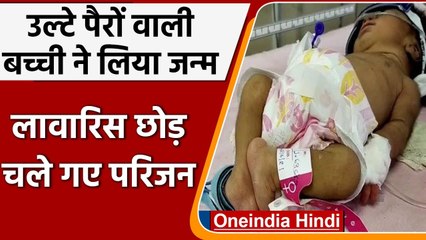 MP में जन्मी उल्टे पैरों वाली बच्ची, बेटी देखते ही लावारिस छोड़कर फरार हो गए परिजन | वनइंडिया हिंदी