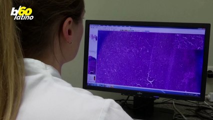 Nuevo Software de Inteligencia Artificial Permitirá Asignar a Los Pacientes Con Cáncer El Tratamiento Más Adecuado