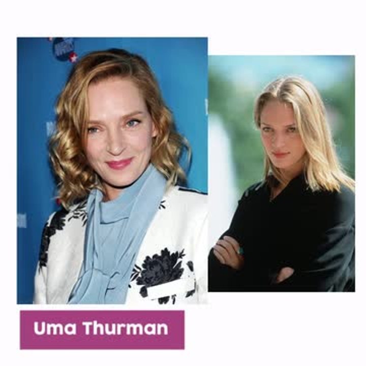 Antes y después famosas cirugía