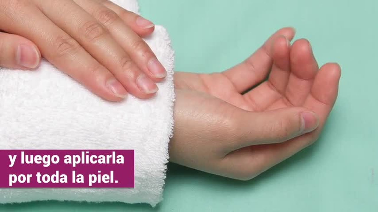 remedios quemaduras solares